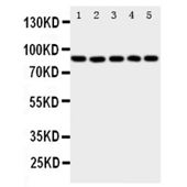 Picture of 5 Lipoxygenase Antibody