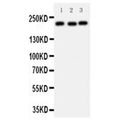 Picture of 53BP1 Antibody