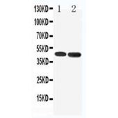 Picture of 5HT1A Receptor Antibody