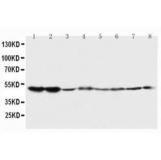 Picture of 5HT2A Receptor Antibody