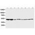 Picture of 5HT2A Receptor Antibody