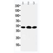 Picture of 5HT3A receptor Antibody