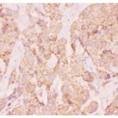 Picture of AAMP Antibody