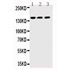 Picture of ABCB11 Antibody