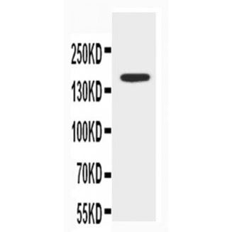Picture of ABCB4 Antibody