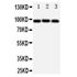 Picture of ABCB6 Antibody