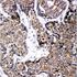 Picture of ABCB6 Antibody