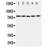 Picture of ABCG1 Antibody