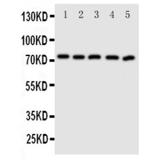 Picture of ABCG5 Antibody