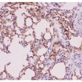 Picture of ACE Antibody