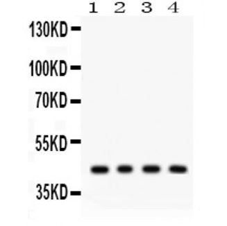 Picture of ADIPOR1 Antibody
