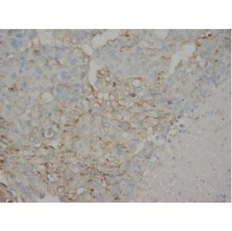 Picture of AFP Antibody (monoclonal)