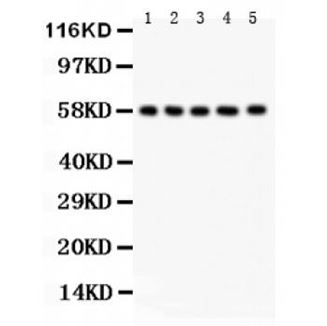 Picture of AGFG1 Antibody