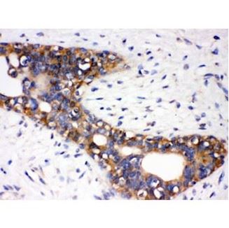 Picture of AGTR1 Antibody