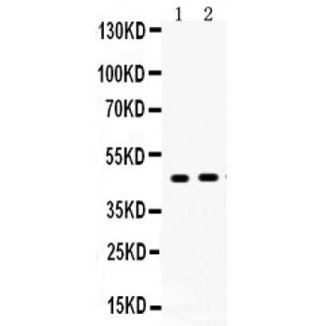 Picture of AGTR2 Antibody