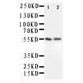 Picture of ALDH1A1 Antibody