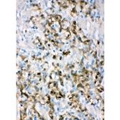 Picture of ALDH3A1 Antibody