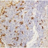 Picture of Alpha Amylase 1 Antibody