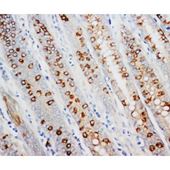 Picture of AMD1 Antibody