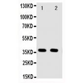Picture of Annexin A10 Antibody
