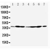 Picture of Annexin A2 Antibody