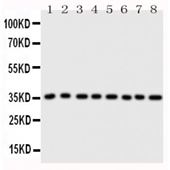 Picture of Annexin A3 Antibody