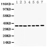 Picture of Annexin A3 Antibody