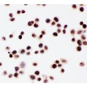 Picture of ARID1A Antibody