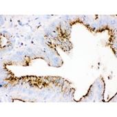 Picture of Cathepsin D Antibody (monoclonal)