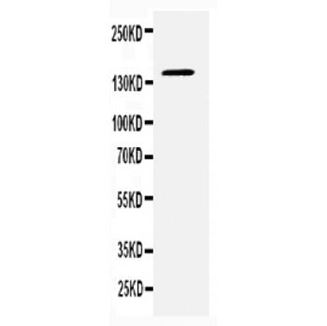 Picture of CD22 Antibody  (Premier)