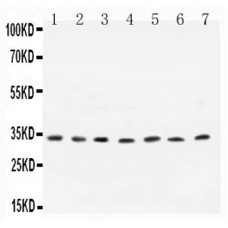 Picture of  Cyclin D1 Antibody
