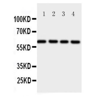 Picture of Osteoprotegerin Antibody