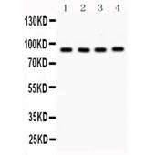 Picture of VCP Antibody