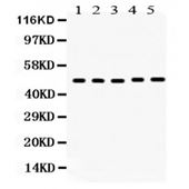 Picture of VDR Antibody