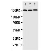 Picture of VE Cadherin Antibody
