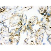 Picture of Vinculin Antibody (monoclonal)