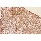 Picture of VR1 Antibody