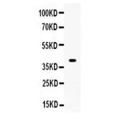 Picture of Wnt1 Antibody