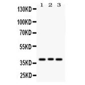 Picture of Wnt2 Antibody