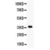 Picture of Wnt4 Antibody