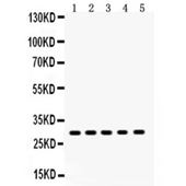 Picture of XBP1 Antibody
