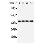 Picture of XRCC3 Antibody