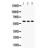 Picture of Yes1 Antibody