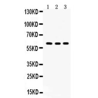 Picture of Yes1 Antibody