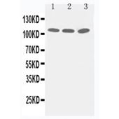 Picture of Zonula occludens protein 3 Antibody