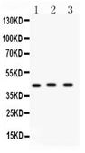 Picture of Anti CD147 Antibody (polyclonal)