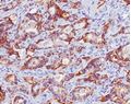 Picture for category Immunohistochemistry (IHC)