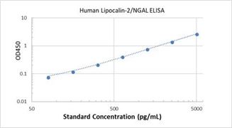 Picture of Human Lipocalin-2/NGAL ELISA Kit