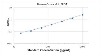 Picture of Human Osteocalcin ELISA Kit
