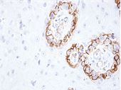 Picture of KBA.62 (Melanoma Associated Antigen) (Premier)